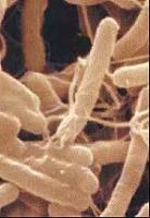helicobacter-pylori.jpg